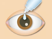 大阪府茨木市、永井眼科の黄斑疾患専門治療