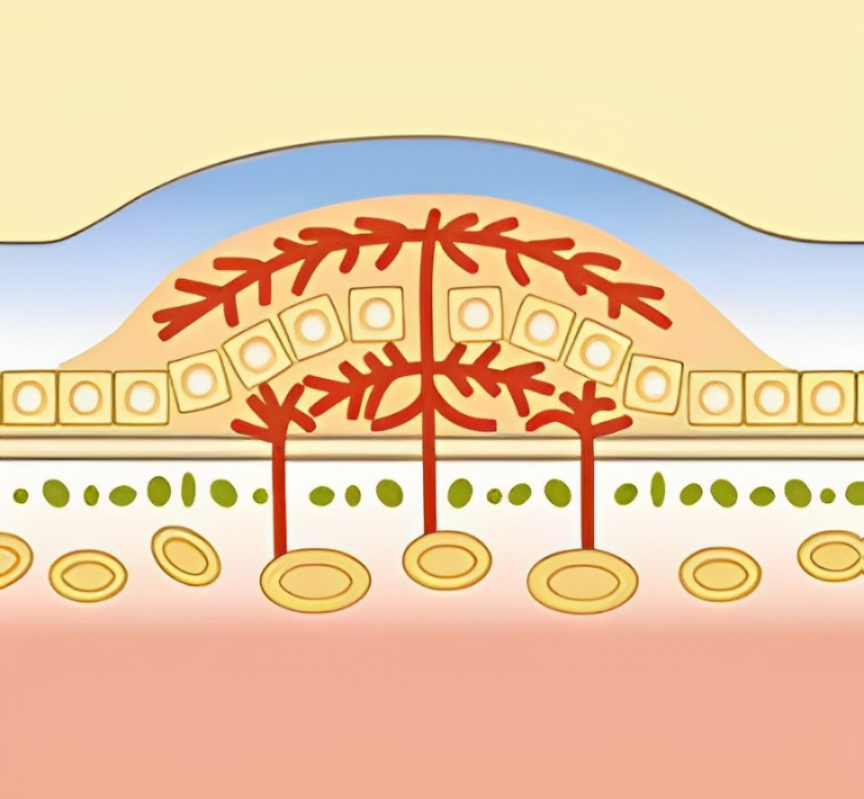 大阪府茨木市の眼科、永井眼科の黄斑疾患の専門治療