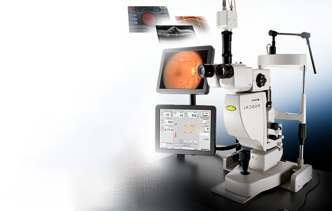 大阪府茨木市の眼科のレーザー光凝固装置